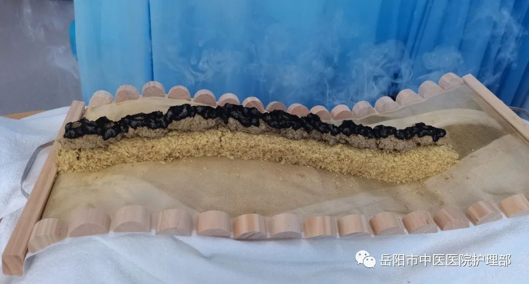 常用艾灸部位参考示意图